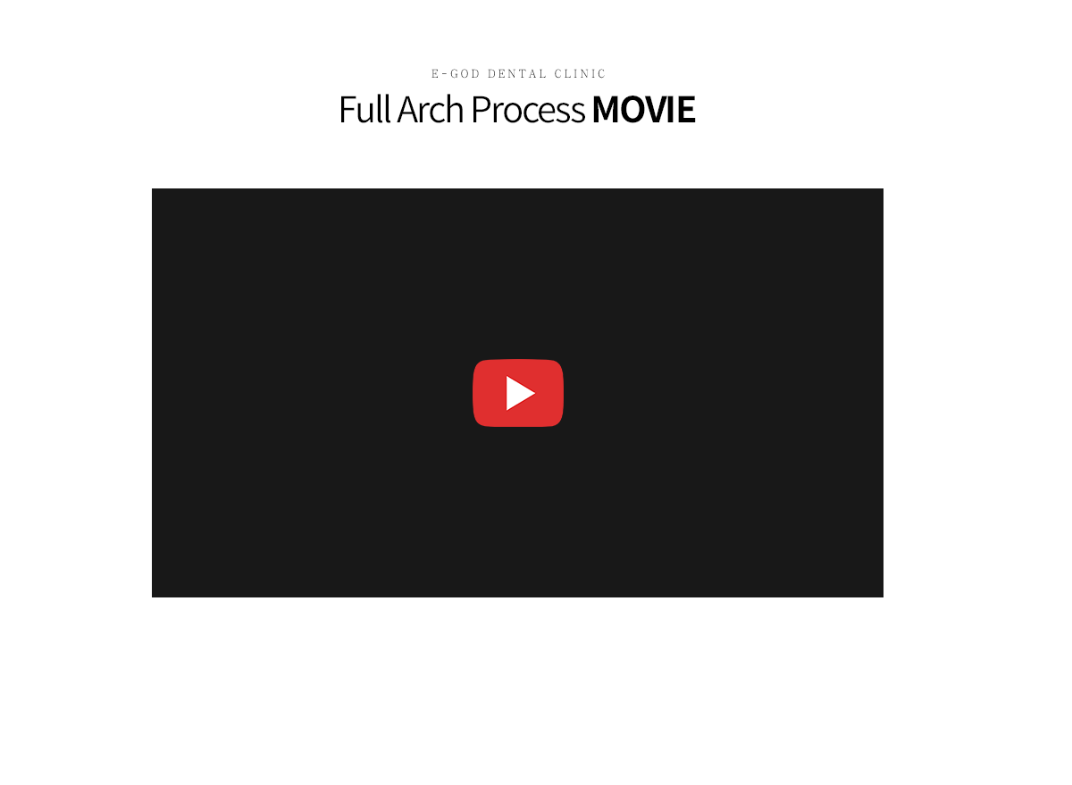 풀아치 임플란트 MOVIE